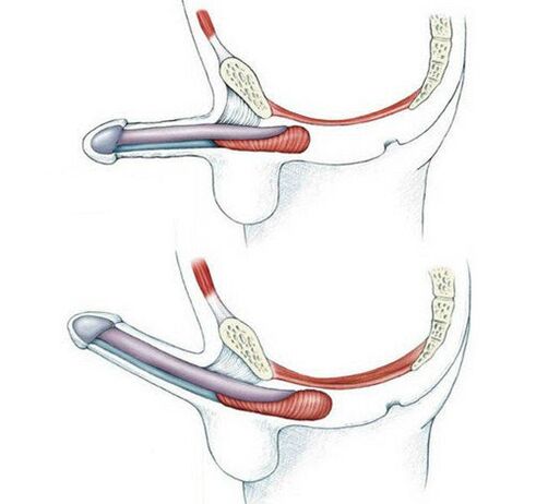 Penis without pubococcygeus muscle exercise and then