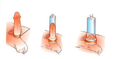 Pump work principle to enhance the penis