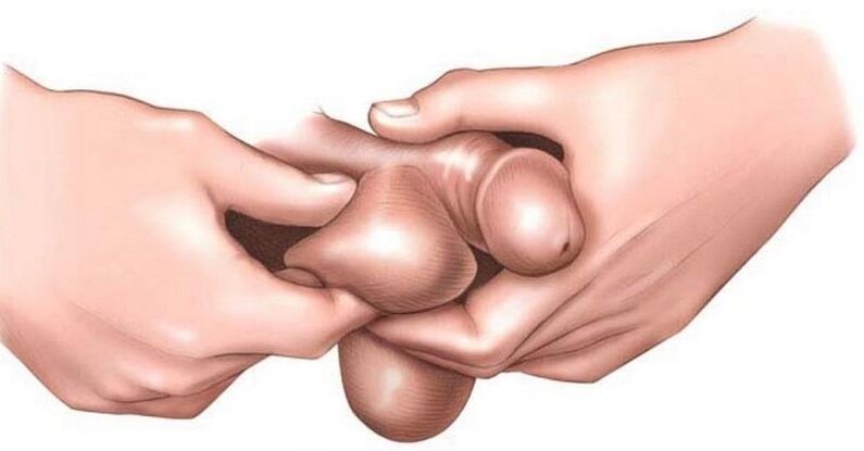 Why are eggs in itching in men